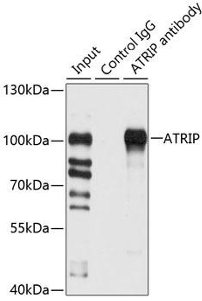 ChIP Antibodies Anti-ATRIP Antibody CAB7139