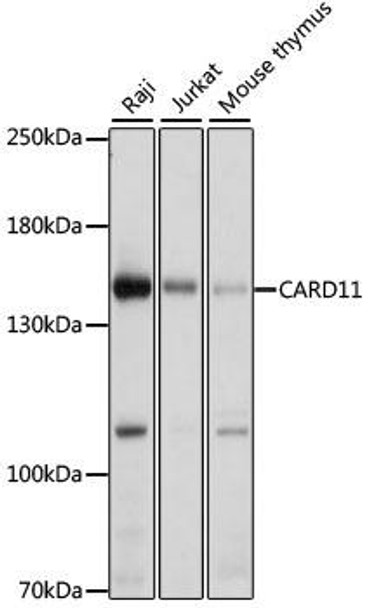 Cell Biology Antibodies 11 Anti-CARD11 Antibody CAB7140