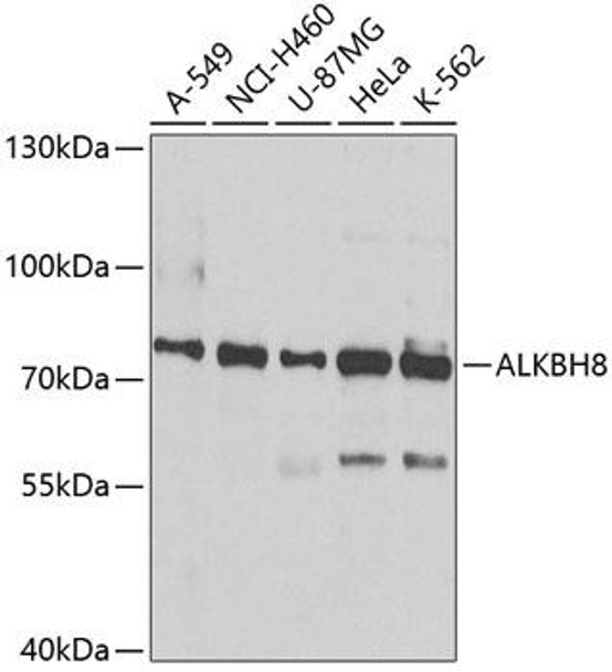 Cell Biology Antibodies 11 Anti-ALKBH8 Antibody CAB7142