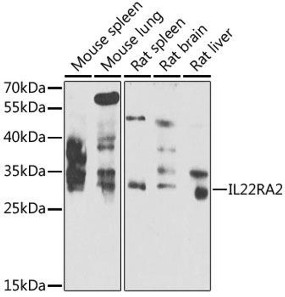 Cell Biology Antibodies 11 Anti-IL-22RA2 Antibody CAB7145