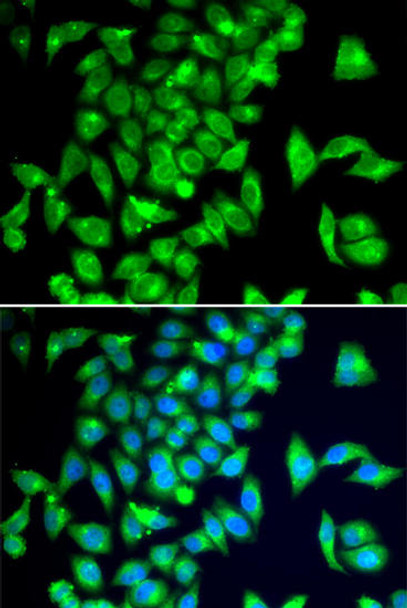 Neuroscience Anti-TPH2 Antibody CAB7147