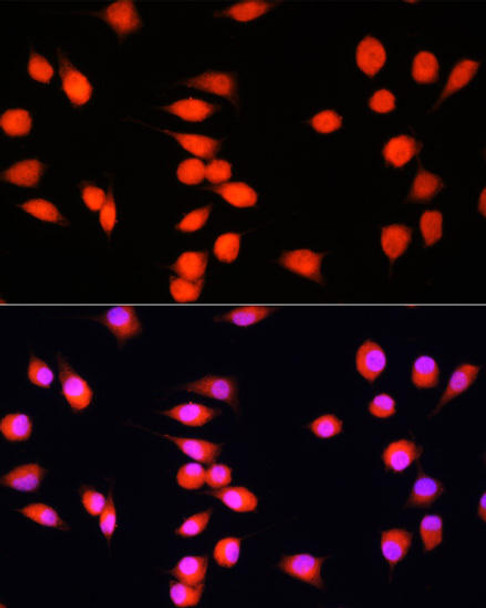 Cell Biology Antibodies 11 Anti-COMMD1 Antibody CAB7149