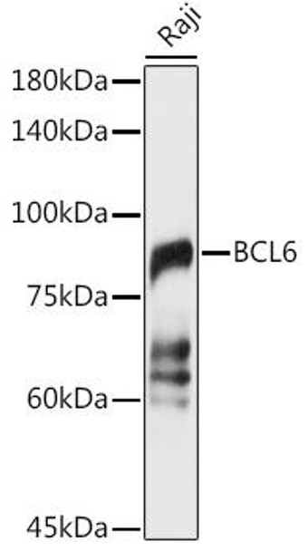 Immunology Antibodies 2 Anti-BCL6 Antibody CAB7173