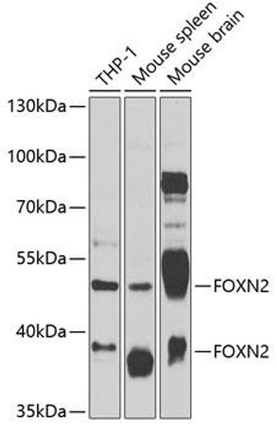 Epigenetics and Nuclear Signaling Antibodies 4 Anti-FOXN2 Antibody CAB7185