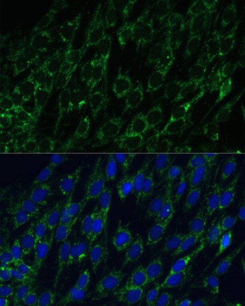 Metabolism Antibodies 2 Anti-IDH2 Antibody CAB7190