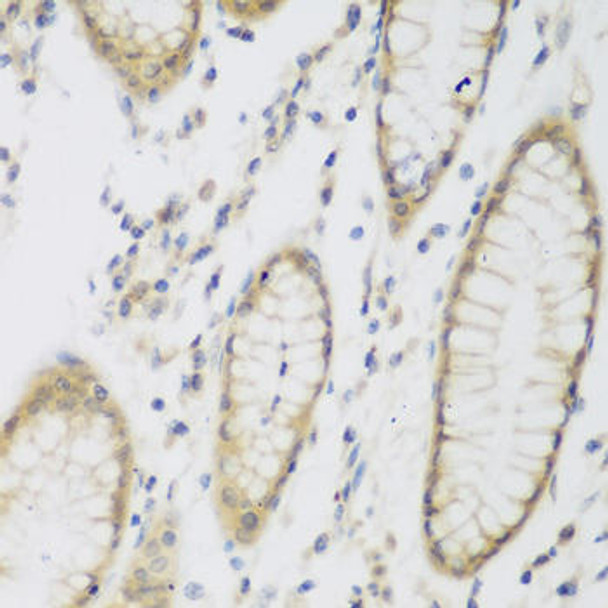 Cell Biology Antibodies 11 Anti-NAT8B Antibody CAB7203