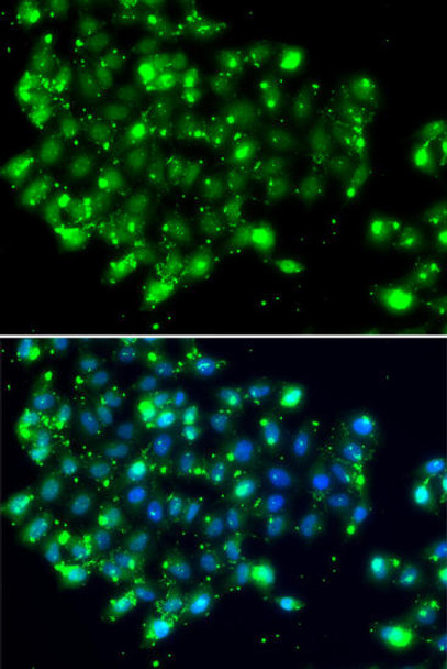 Cell Biology Antibodies 11 Anti-NAT9 Antibody CAB7204