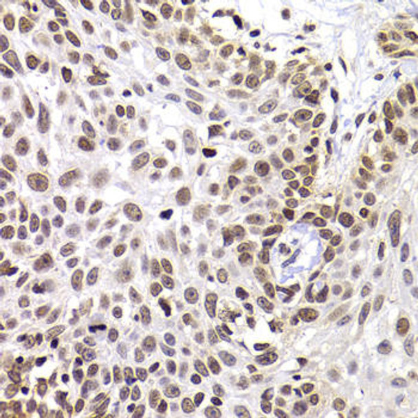 Cell Biology Antibodies 11 Anti-PHIP Antibody CAB7207