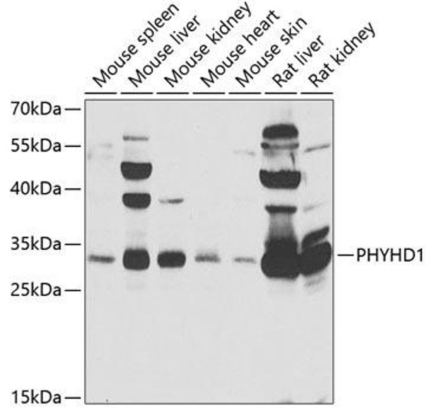 Cell Biology Antibodies 11 Anti-PHYHD1 Antibody CAB7208