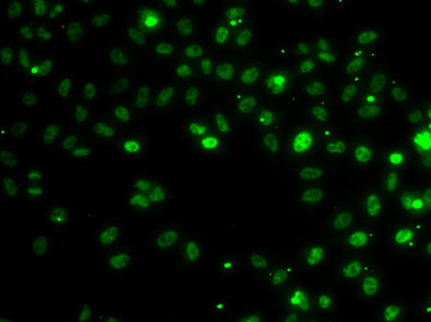 Epigenetics and Nuclear Signaling Antibodies 4 Anti-RSRC1 Antibody CAB7210