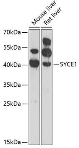 Cell Cycle Antibodies 2 Anti-SYCE1 Antibody CAB7218