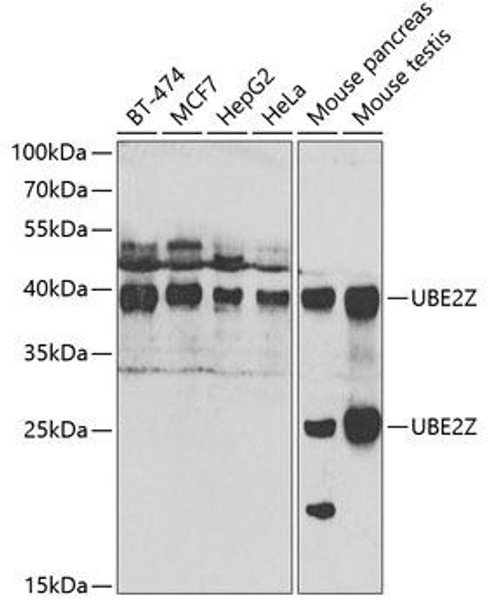 Cell Death Antibodies 2 Anti-UBE2Z Antibody CAB7225
