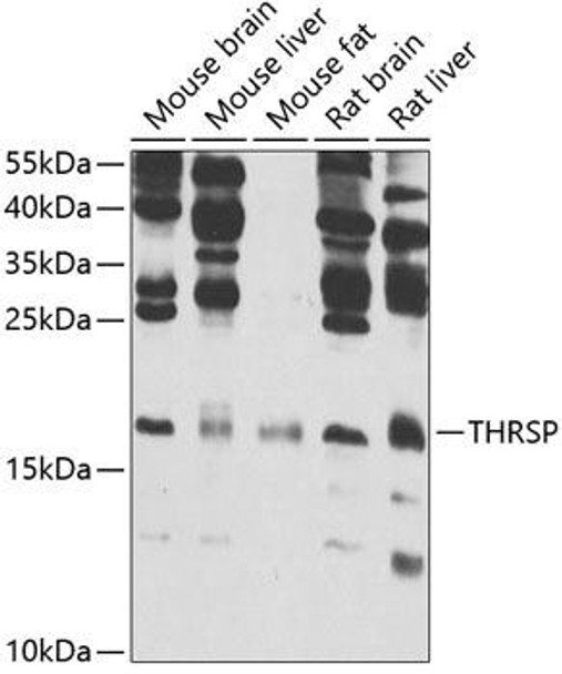 Metabolism Antibodies 2 Anti-THRSP Antibody CAB7232