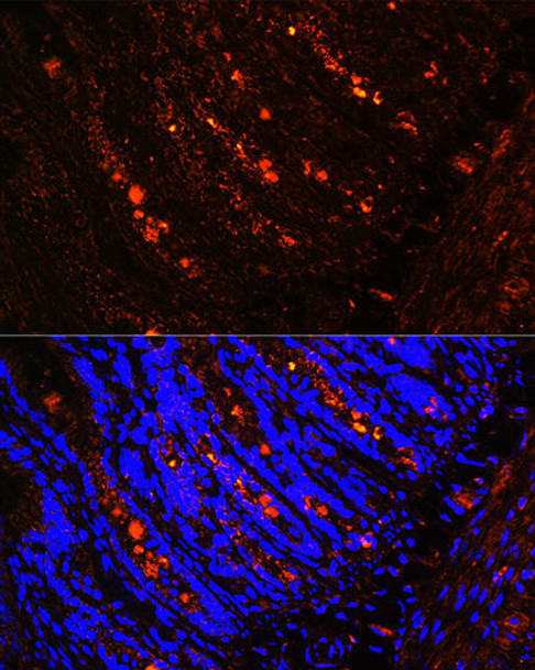 Cell Biology Antibodies 11 Anti-ITLN1 Antibody CAB7234