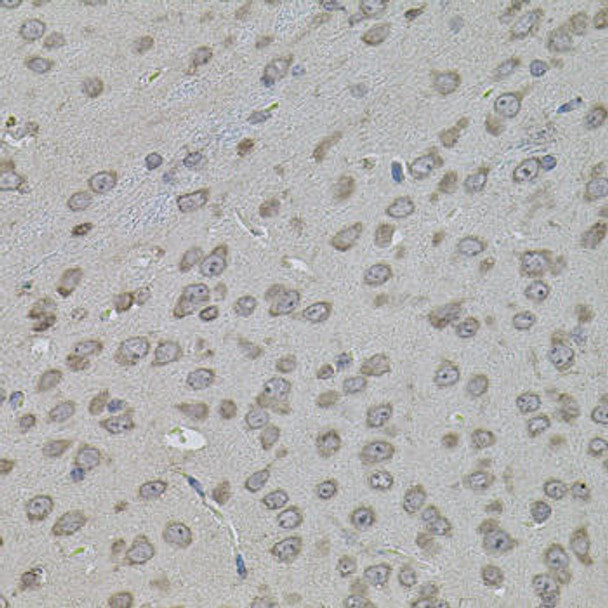 Cell Biology Antibodies 11 Anti-ATF4 Antibody CAB7237