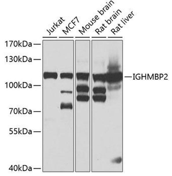 Cell Biology Antibodies 16 Anti-IGHMBP2 Antibody CAB7240
