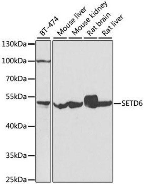 Cell Biology Antibodies 11 Anti-SETD6 Antibody CAB7242