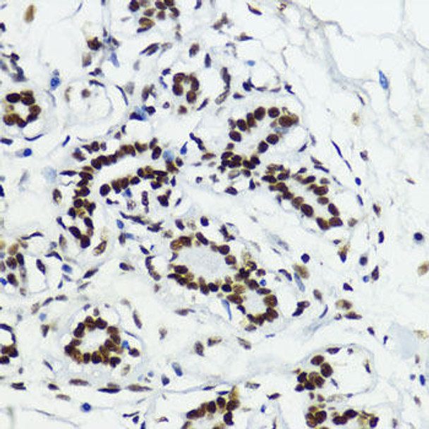 Epigenetics and Nuclear Signaling Antibodies 4 Anti-Acetyl-Histone H3-K27 Antibody CAB7253