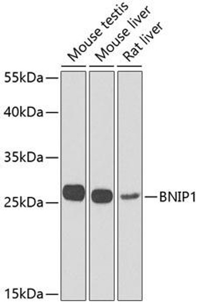 Cell Death Antibodies 2 Anti-BNIP1 Antibody CAB7263
