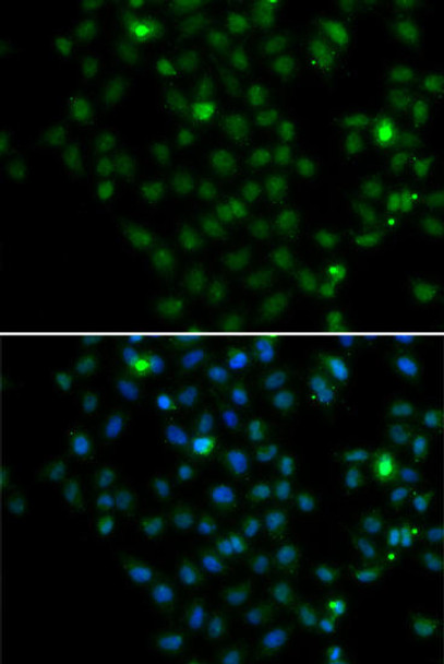 Epigenetics and Nuclear Signaling Antibodies 4 Anti-LMO4 Antibody CAB7268