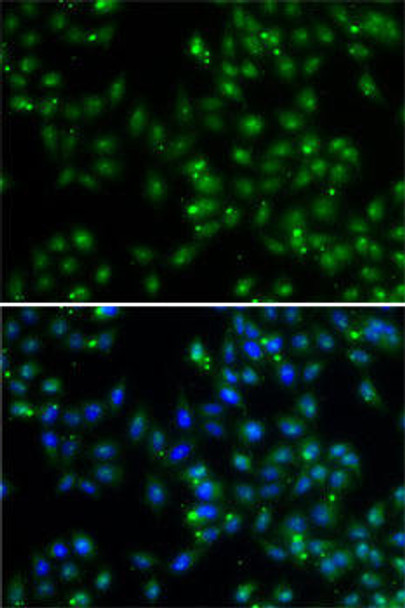 Cell Biology Antibodies 11 Anti-DUSP22 Antibody CAB7281