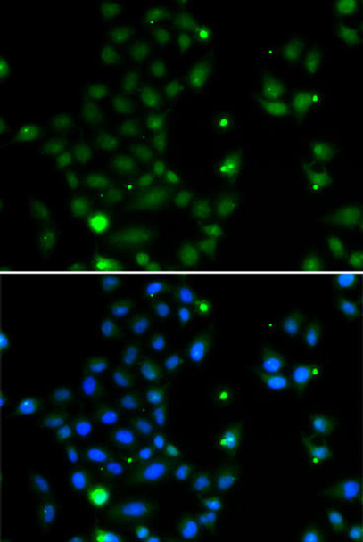 Epigenetics and Nuclear Signaling Antibodies 4 Anti-GCM1 Antibody CAB7282