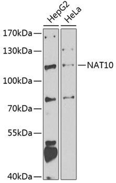 Epigenetics and Nuclear Signaling Antibodies 4 Anti-NAT10 Antibody CAB7292
