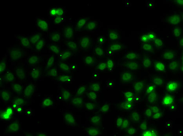 Cell Death Antibodies 2 Anti-NGFRAP1 Antibody CAB7296