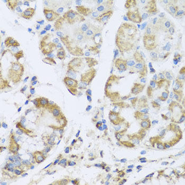 Metabolism Antibodies 2 Anti-PRKAG1 Antibody CAB7300