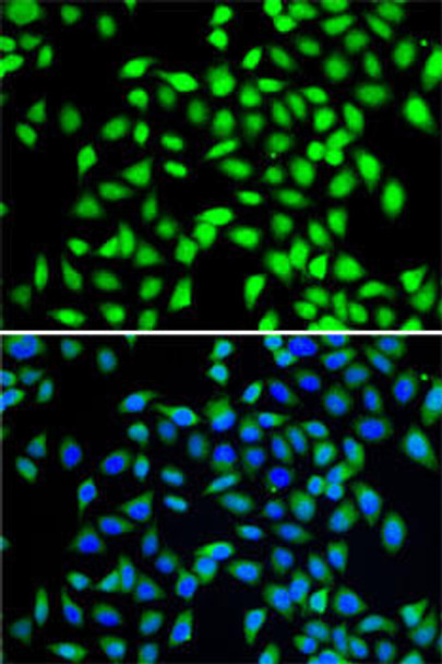 KO Validated Antibodies 1 Anti-SGTA Antibody CAB7306KO Validated