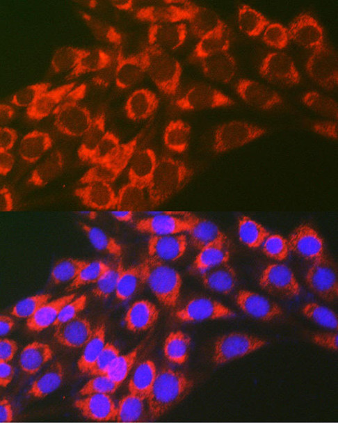 Immunology Antibodies 2 Anti-TFEB Antibody CAB7311