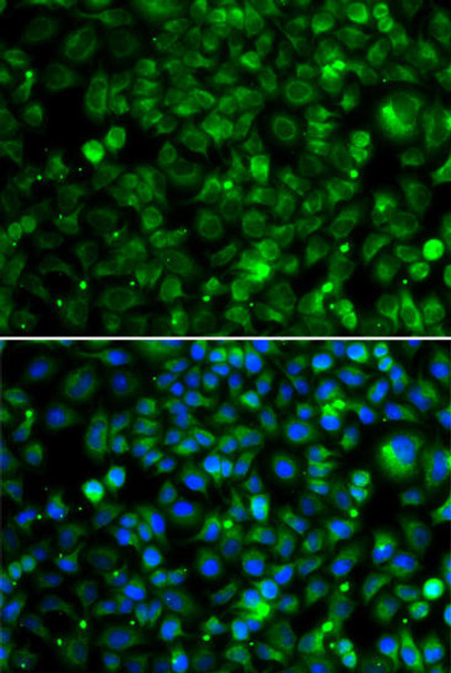 Metabolism Antibodies 2 Anti-TMLHE Antibody CAB7312