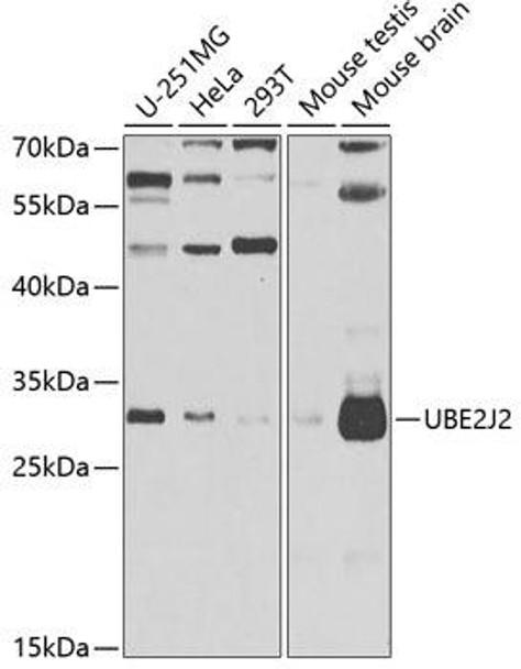 Signal Transduction Antibodies 3 Anti-UBE2J2 Antibody CAB7316