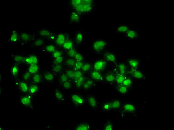 Cell Biology Antibodies 11 Anti-WBSCR22 Antibody CAB7317