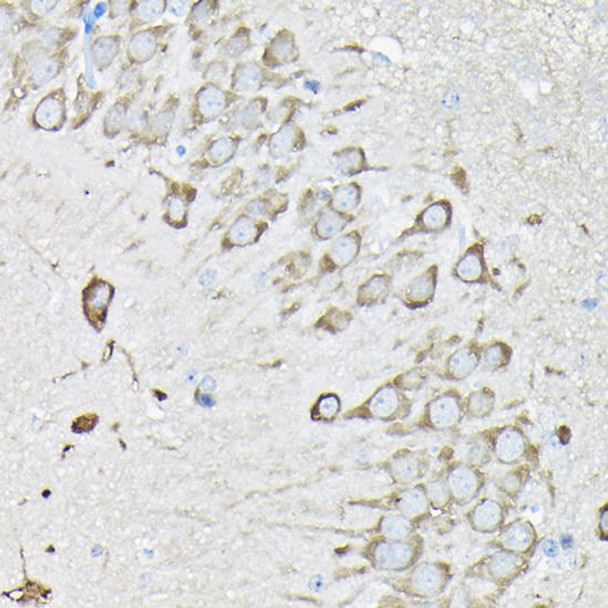 Metabolism Antibodies 2 Anti-EEF1A2 Antibody CAB7327