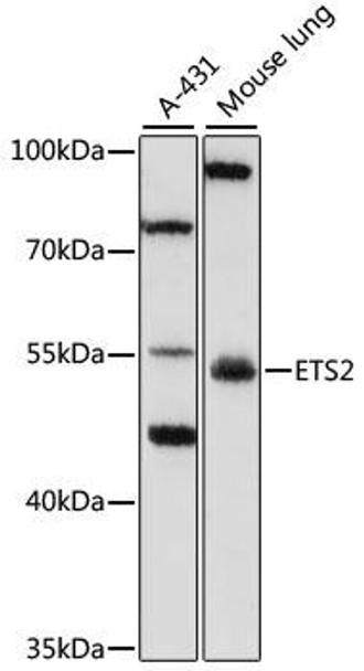 Epigenetics and Nuclear Signaling Antibodies 4 Anti-ETS2 Antibody CAB7329