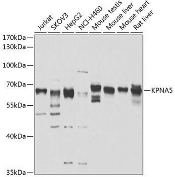 Immunology Antibodies 2 Anti-KPNA5 Antibody CAB7331
