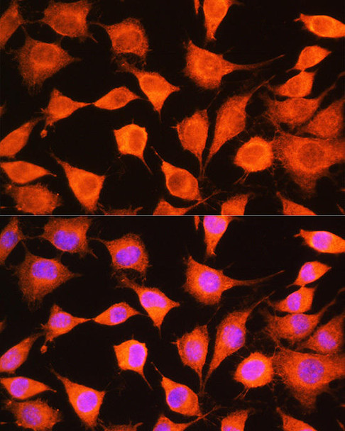 Metabolism Antibodies 2 Anti-PHKG2 Antibody CAB7337