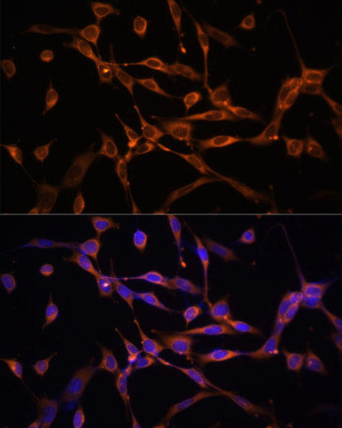 KO Validated Antibodies 1 Anti-AMPKAlpha2 Antibody CAB7339KO Validated