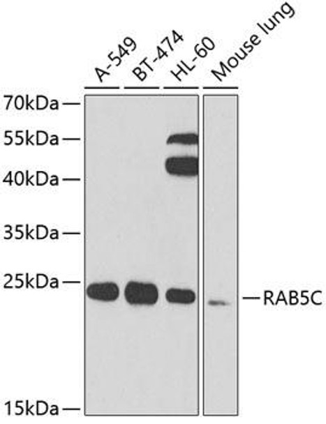 Cell Biology Antibodies 11 Anti-RAB5C Antibody CAB7342