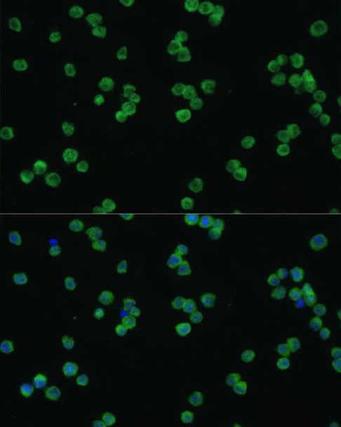 Signal Transduction Antibodies 3 Anti-LZTR1 Antibody CAB7350