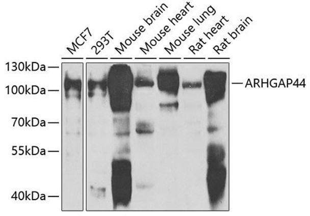 Cell Biology Antibodies 11 Anti-ARHGAP44 Antibody CAB7357