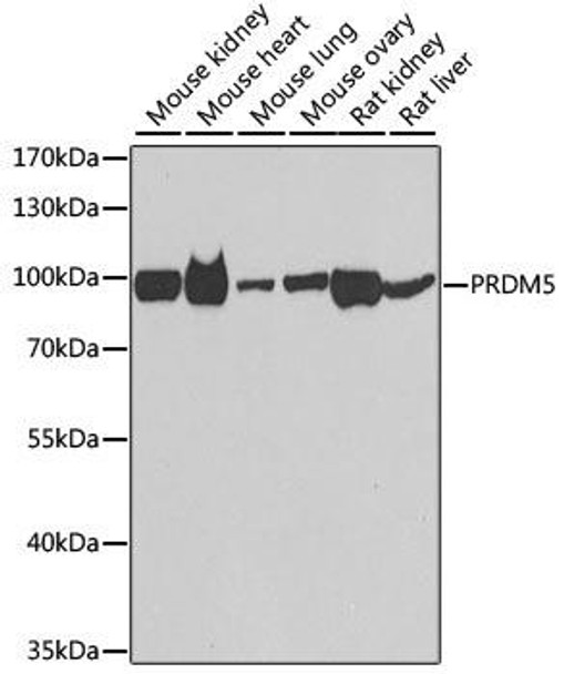 Epigenetics and Nuclear Signaling Antibodies 4 Anti-PRDM5 Antibody CAB7361