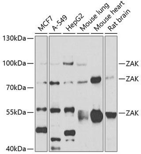 Cell Biology Antibodies 16 Anti-ZAK Antibody CAB7371