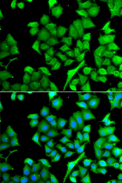 Cell Biology Antibodies 11 Anti-NAA50 Antibody CAB7387