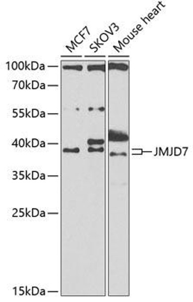 Cell Biology Antibodies 11 Anti-JMJD7 Antibody CAB7408