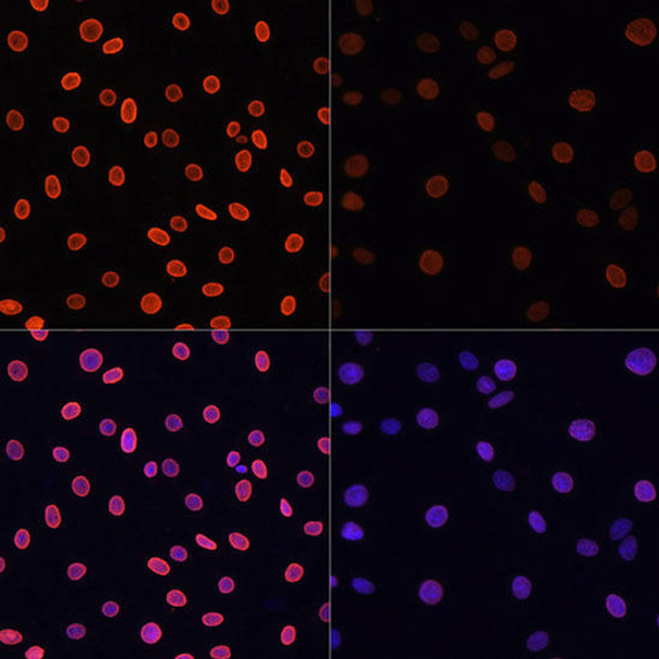 Cell Biology Antibodies 11 Anti-Acetyl-Histone H4-K91 Antibody CAB7409