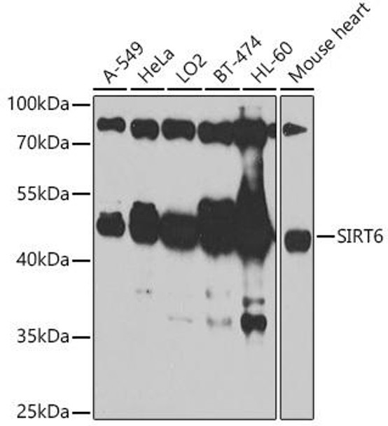 Cell Biology Antibodies 11 Anti-SIRT6 Antibody CAB7416