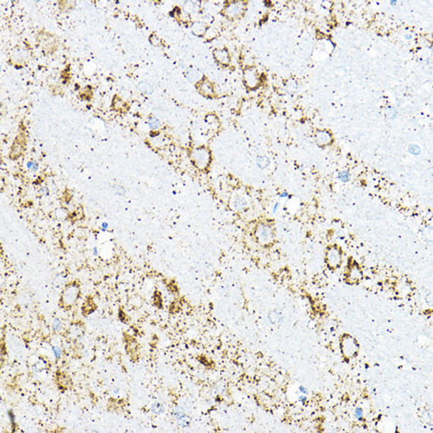 Metabolism Antibodies 2 Anti-BCAT2 Antibody CAB7426