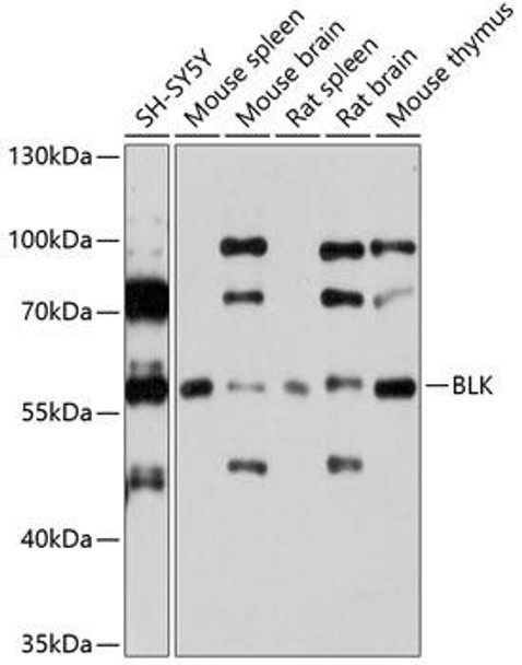 Cell Biology Antibodies 11 Anti-BLK Antibody CAB7427